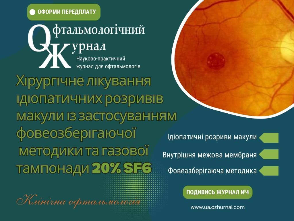 Хірургічне лікування ідіопатичних розривів макули із застосуванням фовеозерігаючої методики та газової тампонади 20% SF6