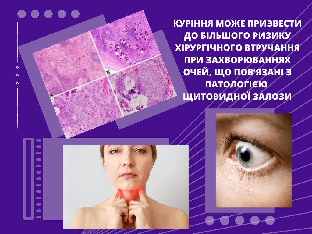 Куріння може призвести до більшого ризику
