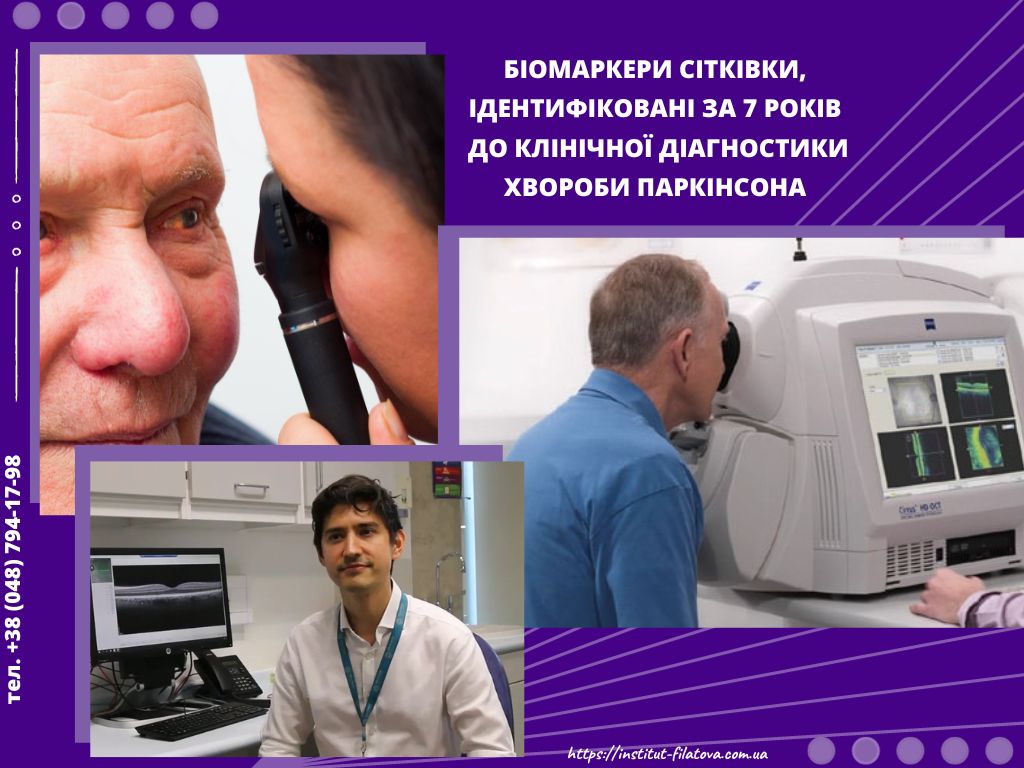 Біомаркери сітківки, ідентифіковані за 7 років до клінічної діагностики хвороби Паркінсона