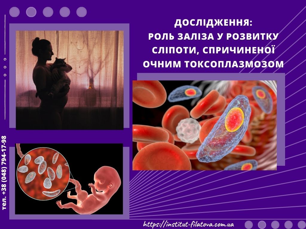 Дослідження: Роль заліза в сліпоті, спричиненої очним токсоплазмозом