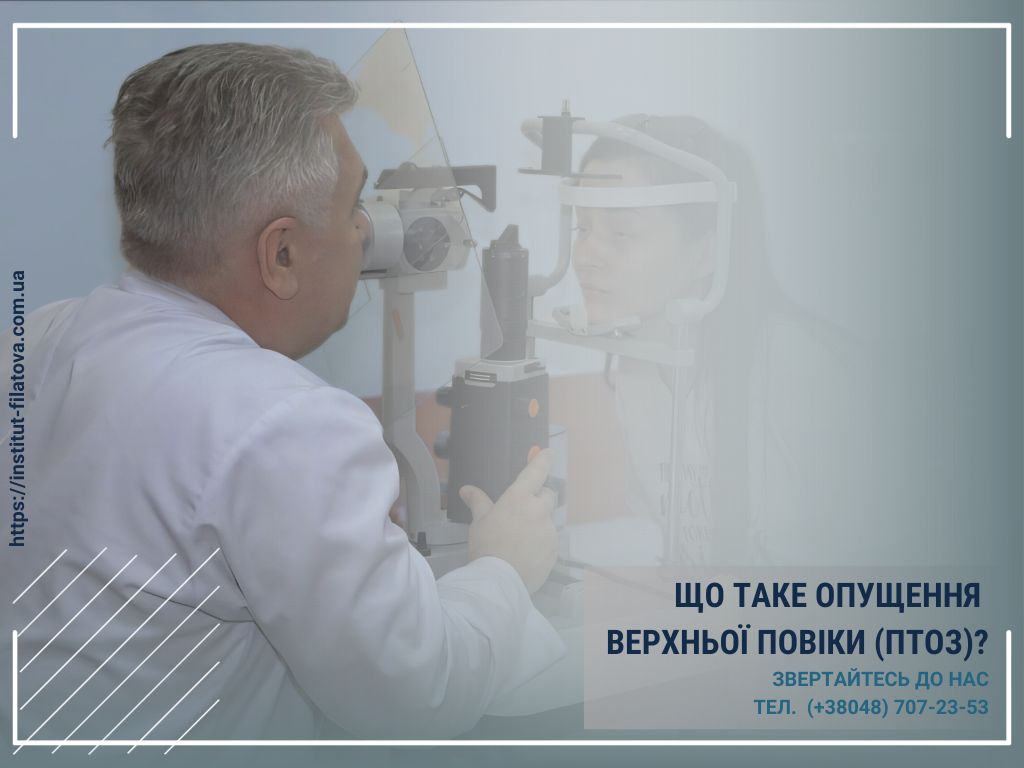 ЩО ТАКЕ ОПУЩЕННЯ ВЕРХНЬОЇ ПОВІКИ