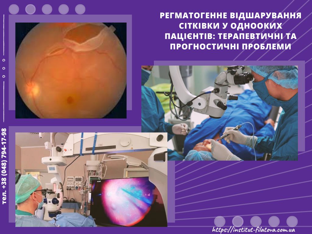 Регматогенне відшарування сітківки у однооких паціентів: терапевтичні та прогностичні проблеми