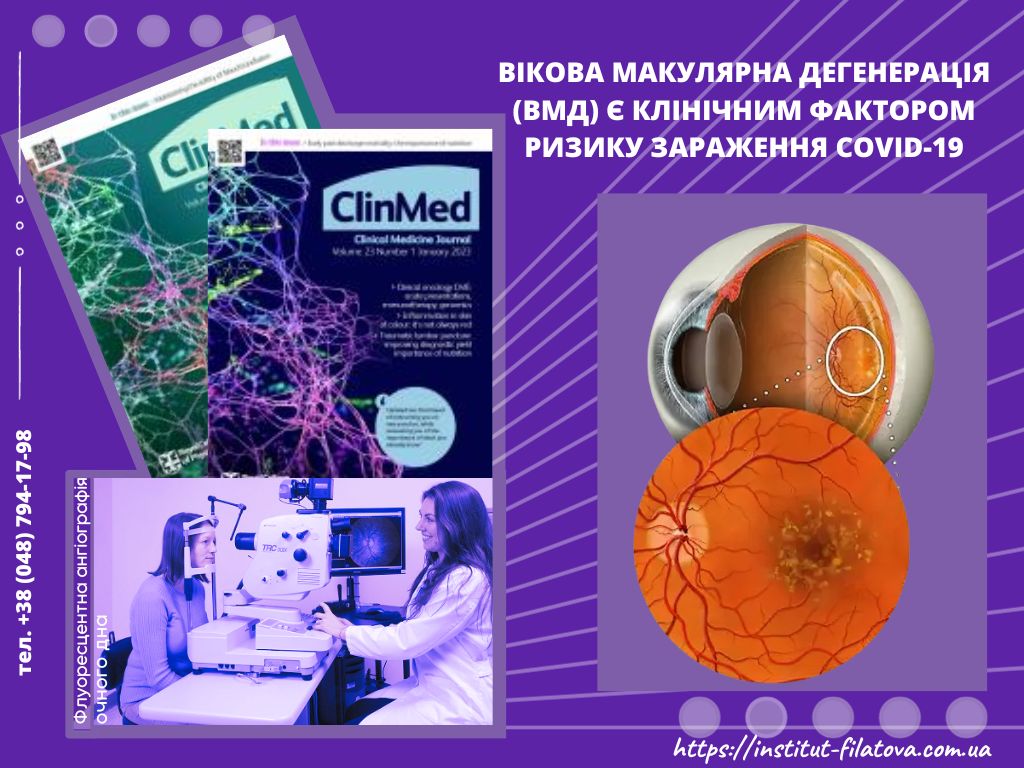 Вікова макулярна дегенерація (ВМД) є клінічним фактором ризику зараження COVID-19