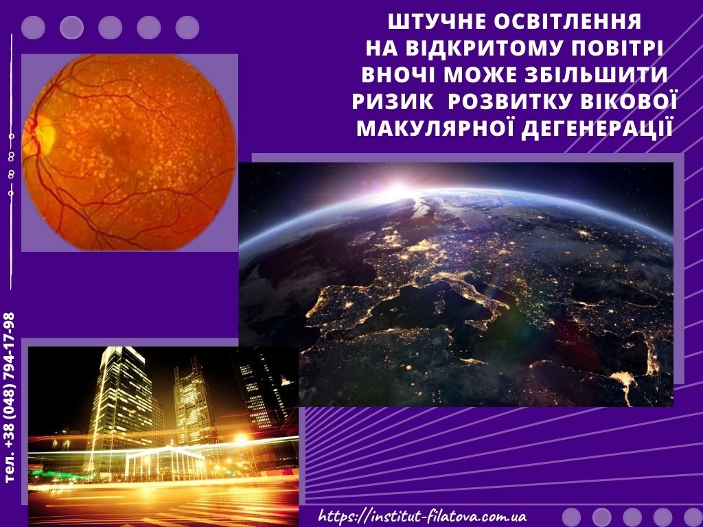 Штучне освітлення на відкритому повітрі вночі може збільшити ризик вікової макулярної дегенерації