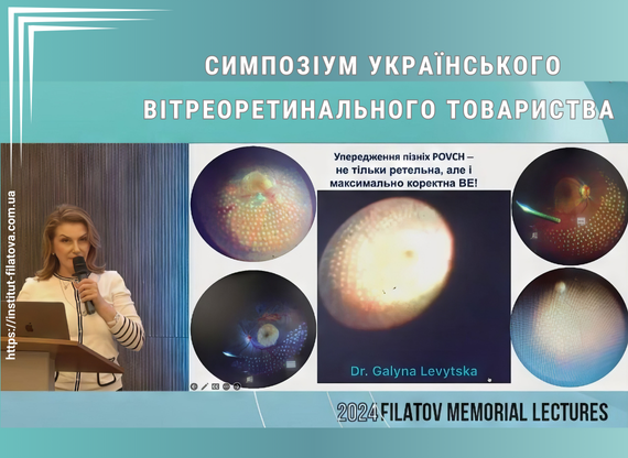 Симпозіум українського вітреоретинального товариства