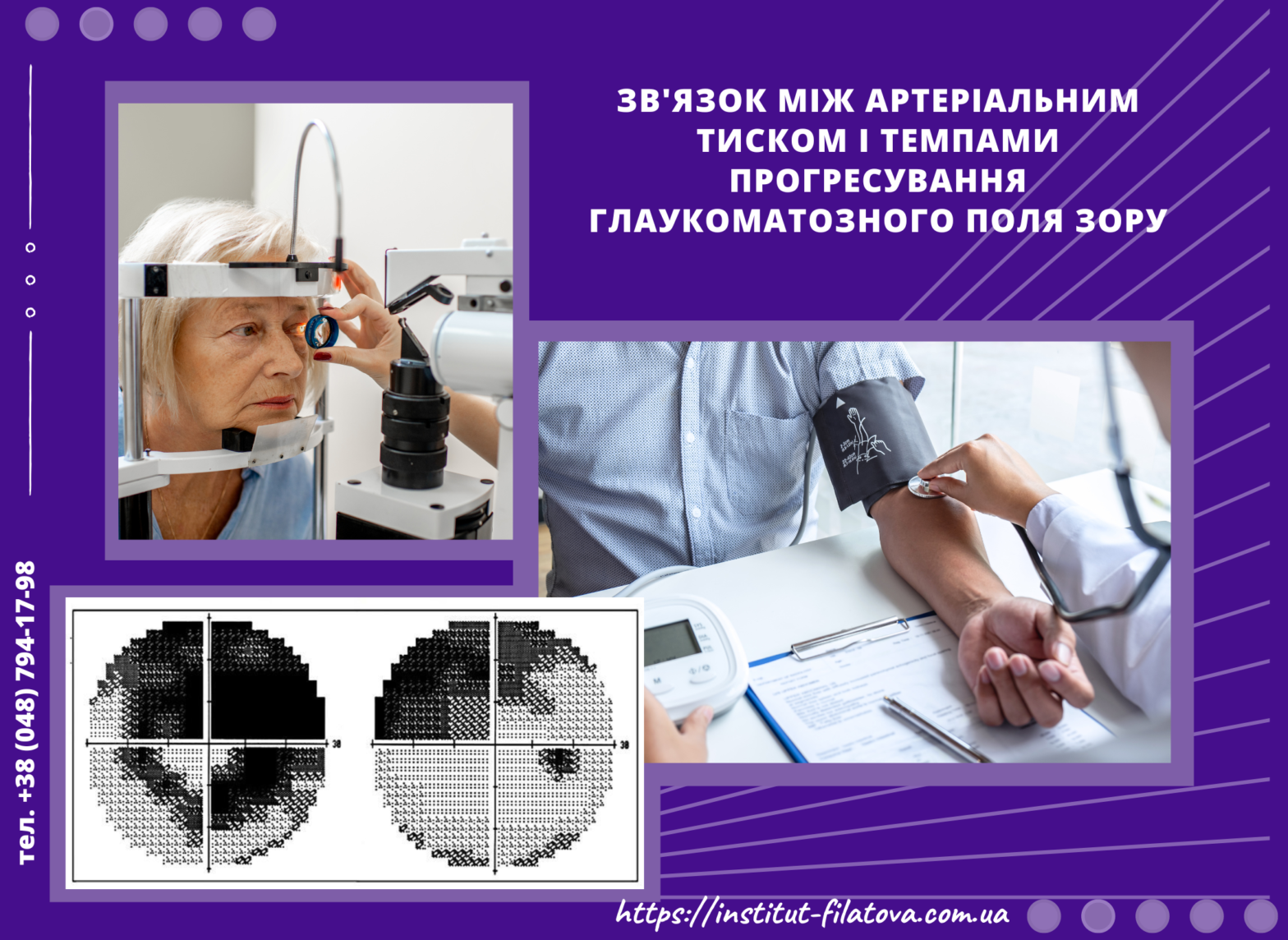 Зв’язок між артеріальним тиском і темпами прогресування глаукоматозного поля зору