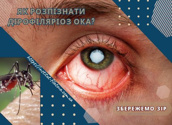 Як розпізнати дірофіляріоз ока?