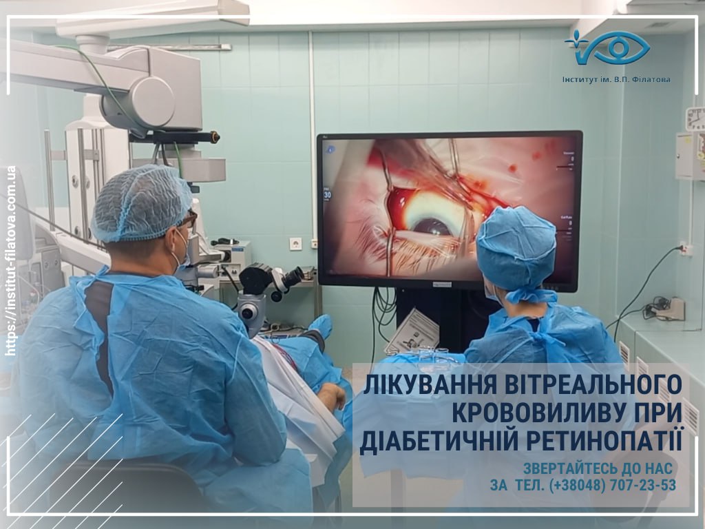 ð ЛІКУВАННЯ ВІТРЕАЛЬНОГО КРОВОВИЛИВУ ПРИ ДІАБЕТИЧНІЙ РЕТИНОПАТІЇ