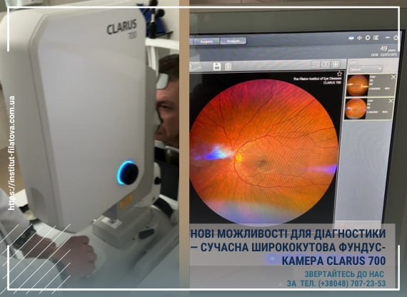 НОВІ МОЖЛИВОСТІ ДЛЯ ДІАГНОСТИКИ — СУЧАСНА ШИРОКОКУТОВА ФУНДУС-КАМЕРА CLARUS 700 ВЖЕ В ІНСТИТУТІ ІМ. В.П. ФІЛАТОВА! ð
