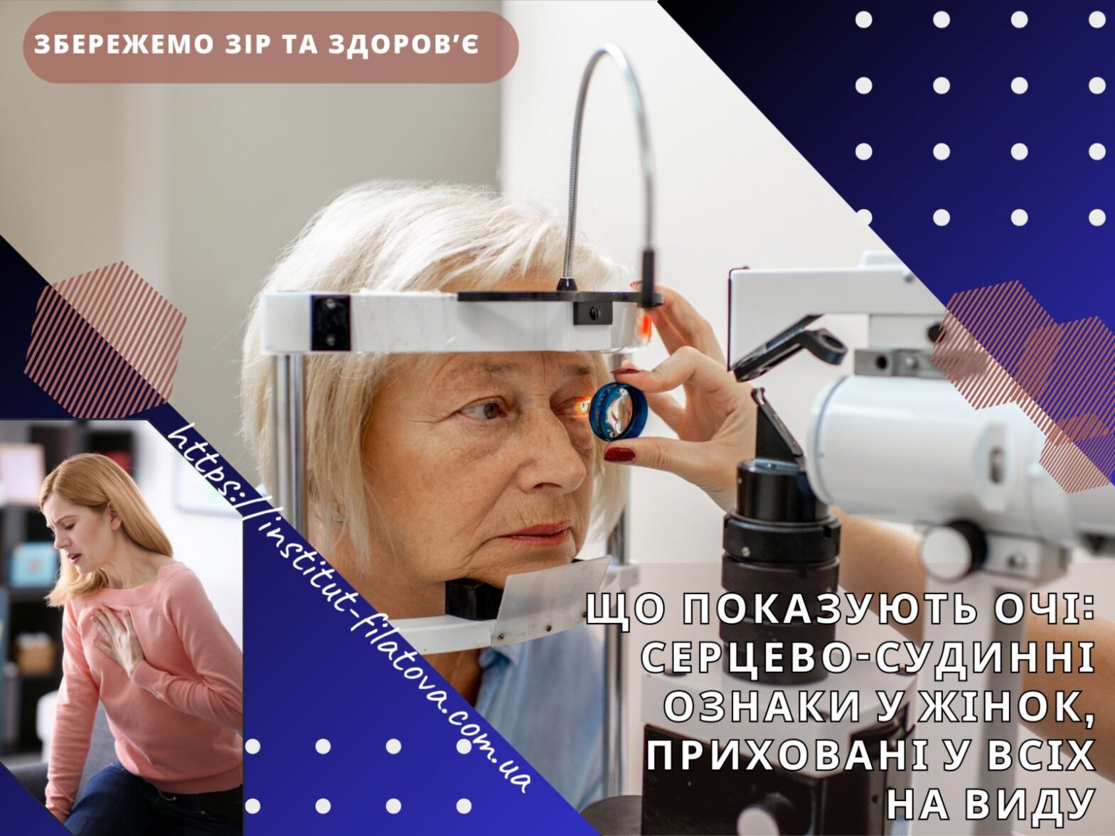 ЩО ПОКАЗУЮТЬ ОЧІ: СЕРЦЕВО-СУДИННІ ОЗНАКИ У ЖІНОК, ПРИХОВАНІ У ВСІХ НА ВИДУ